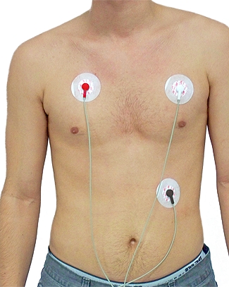 Electrodo para Electrocardiografia ECG EKG