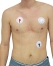 Electrodo para Electrocardiografia ECG EKG